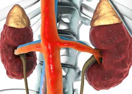 بیماری‌های کلیوی چگونه تشخیص داده می‌شوند؟