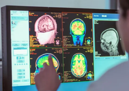 فازهای مغزی جدید: نوجوانی تا ۳۲ سالگی طول می‌کشد