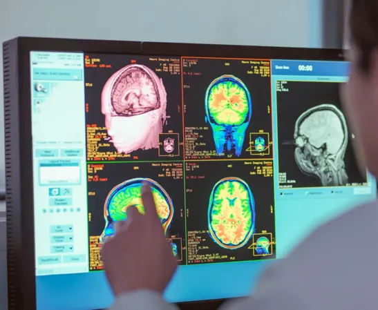 فازهای مغزی جدید: نوجوانی تا ۳۲ سالگی طول میکشد